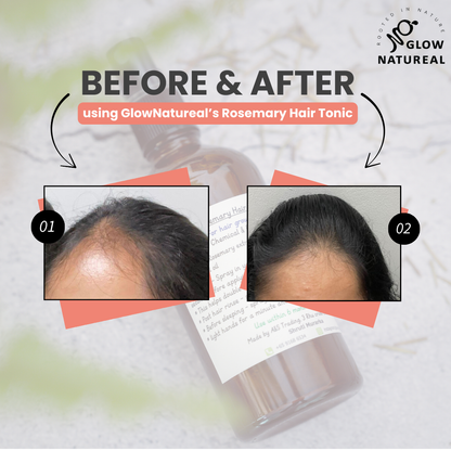 GLOWNATUREAL Rosemary Hair Tonic for Hair Growth & Scalp Health