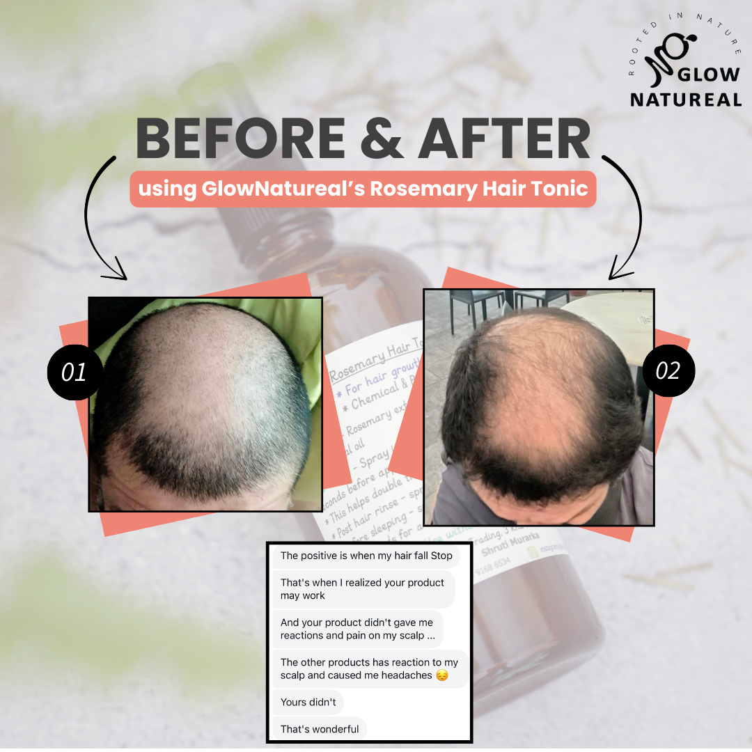 GLOWNATUREAL Rosemary Hair Tonic for Hair Growth & Scalp Health