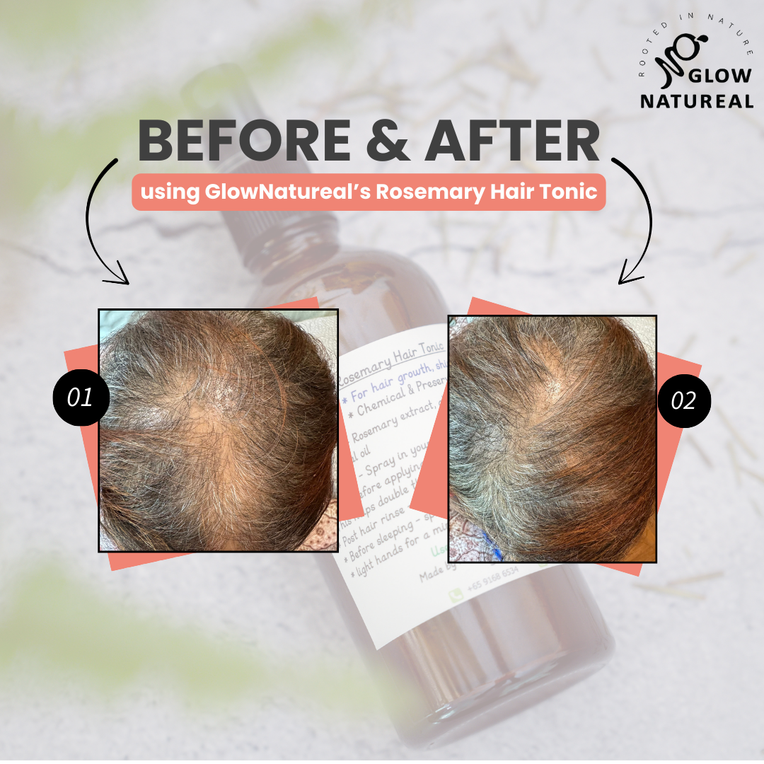 GLOWNATUREAL Rosemary Hair Tonic for Hair Growth & Scalp Health