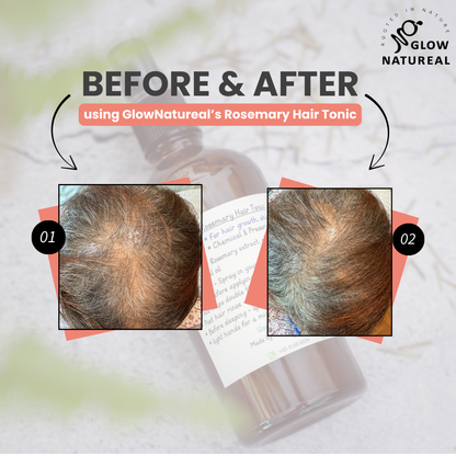GLOWNATUREAL Rosemary Hair Tonic for Hair Growth & Scalp Health