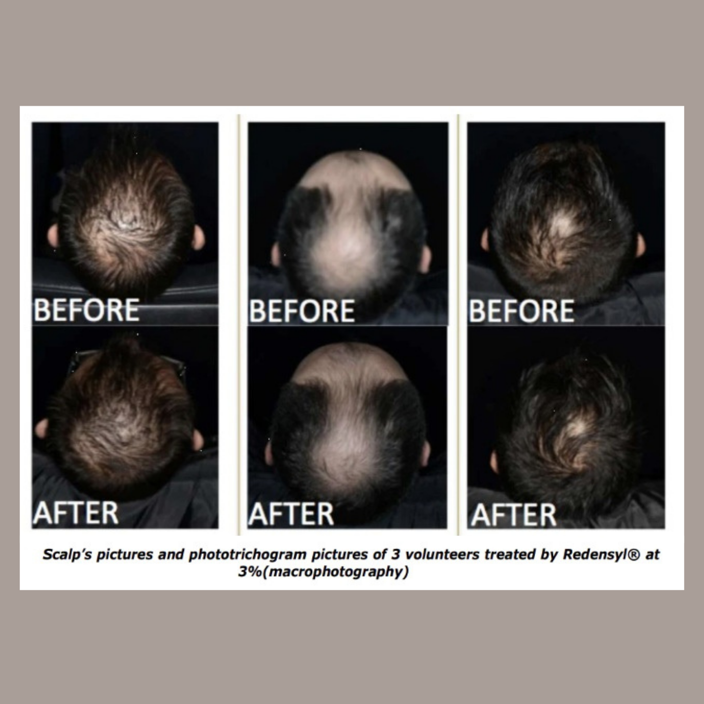 Patrichory Head Start Shampoo Bar To Strengthen & Rejuvenate Thicker Hair 75gm