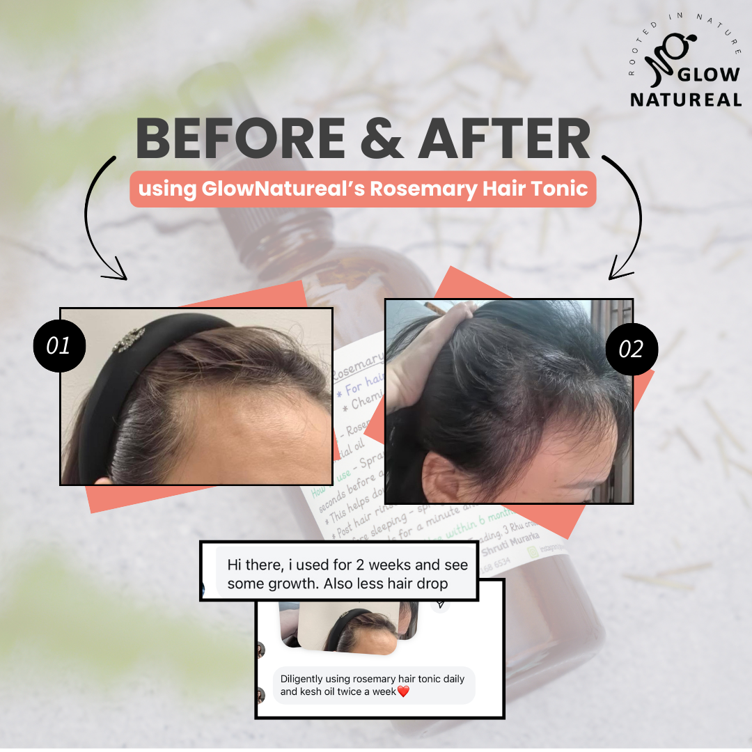 GLOWNATUREAL Rosemary Hair Tonic for Hair Growth & Scalp Health