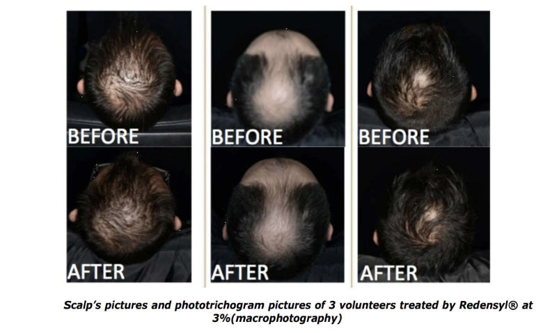 Patrichory Head Start Shampoo Bar To Strengthen & Rejuvenate Thicker Hair 75gm