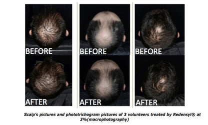 Patrichory Head Start Shampoo Bar To Strengthen & Rejuvenate Thicker Hair 75gm