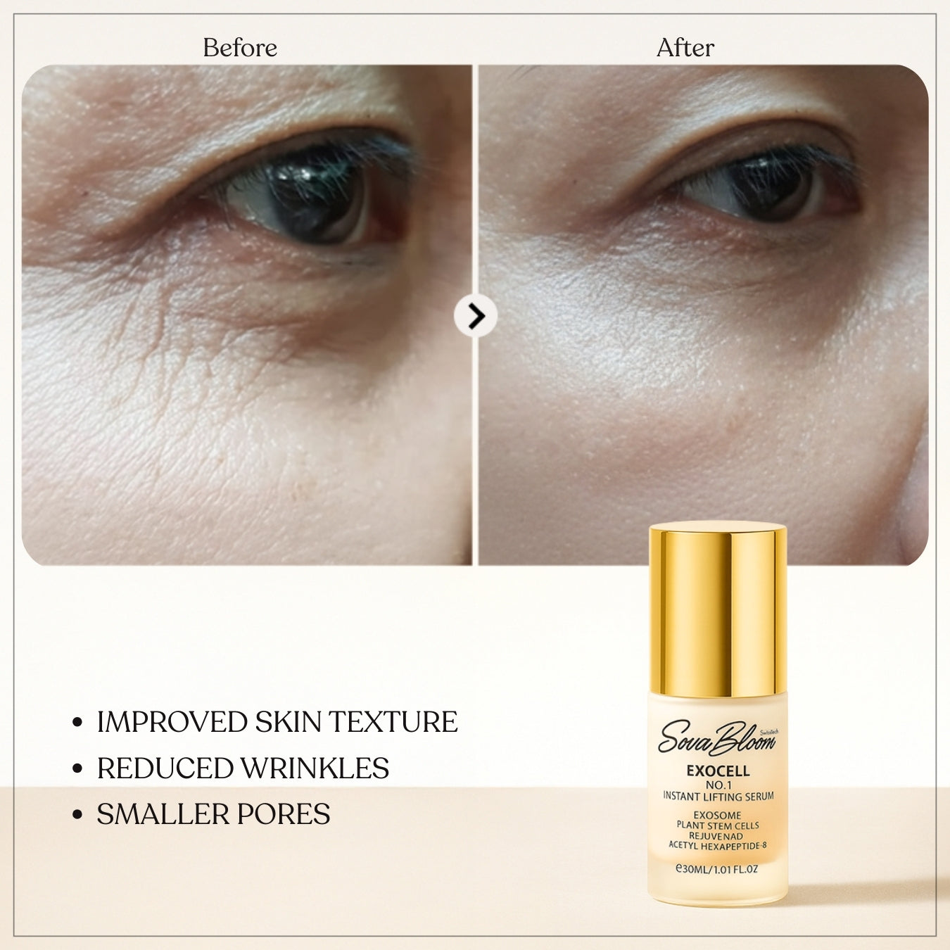 Exocell No.1 Instant Lifting Serum – Advanced Exosome Technology for Firming & Anti-Aging (30ml)
