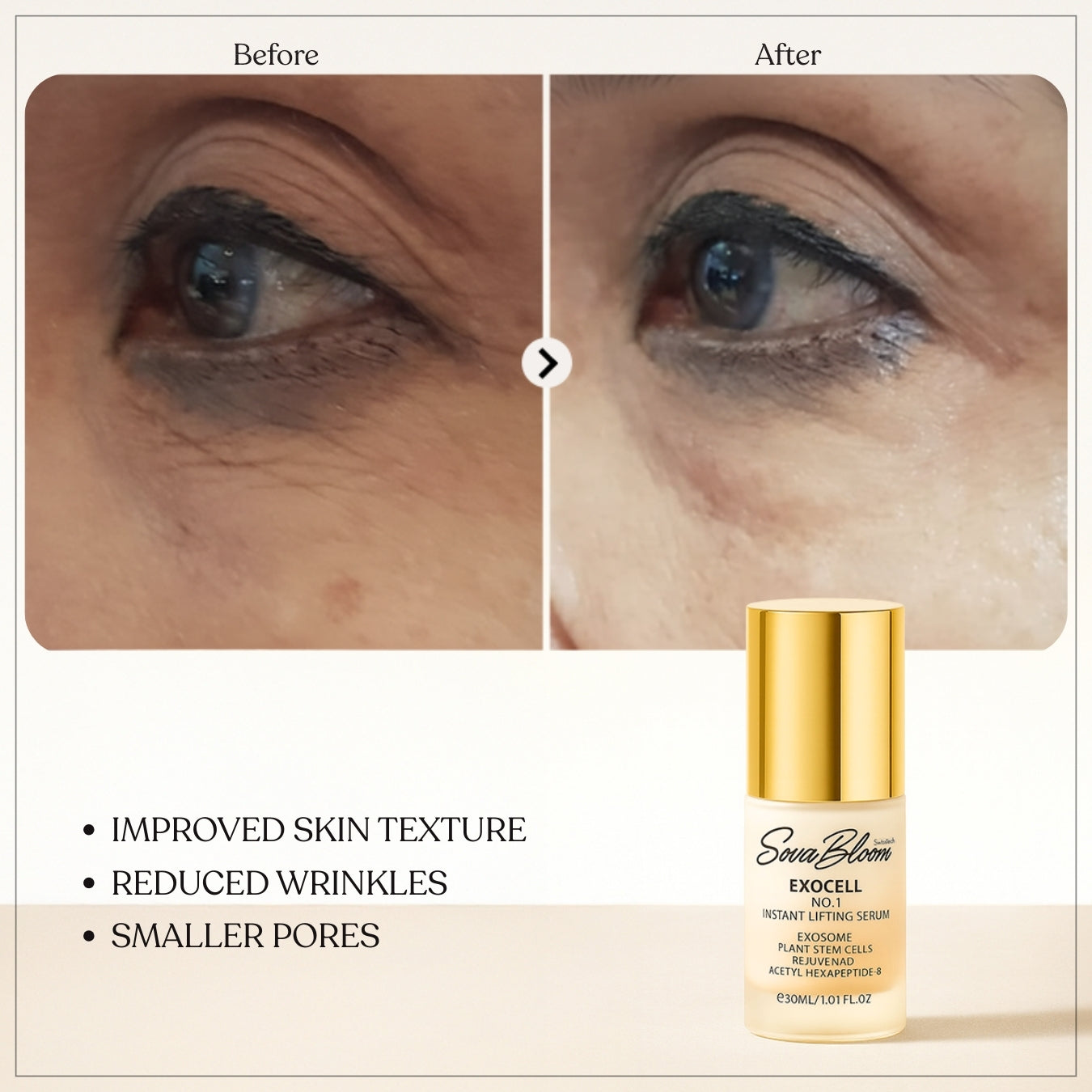 Exocell No.1 Instant Lifting Serum – Advanced Exosome Technology for Firming & Anti-Aging (30ml)