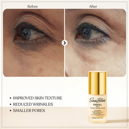 Exocell No.1 Instant Lifting Serum – Advanced Exosome Technology for Firming & Anti-Aging (30ml)
