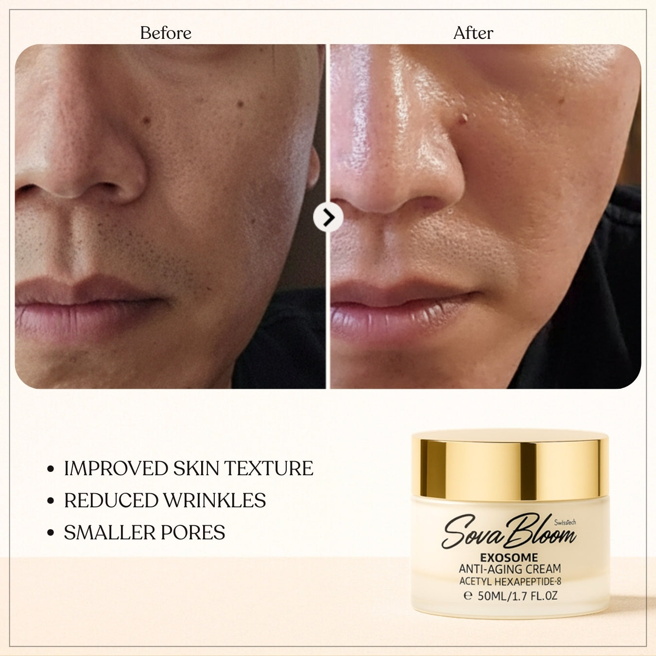 SovaBloom Exosome Anti-Aging Cream – Deep Cellular Repair Face Moisturizer for Wrinkles, Elasticity & Skin Brightening – 50ml