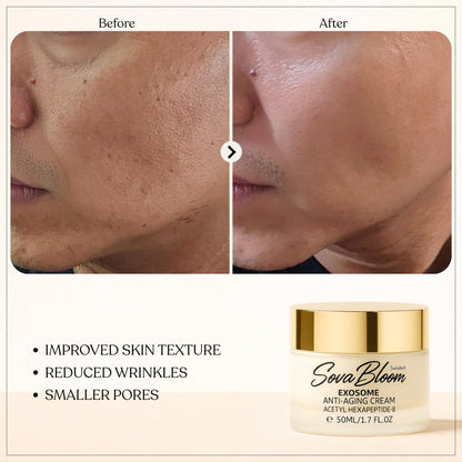 SovaBloom Exosome Anti-Aging Cream – Deep Cellular Repair Face Moisturizer for Wrinkles, Elasticity & Skin Brightening – 50ml