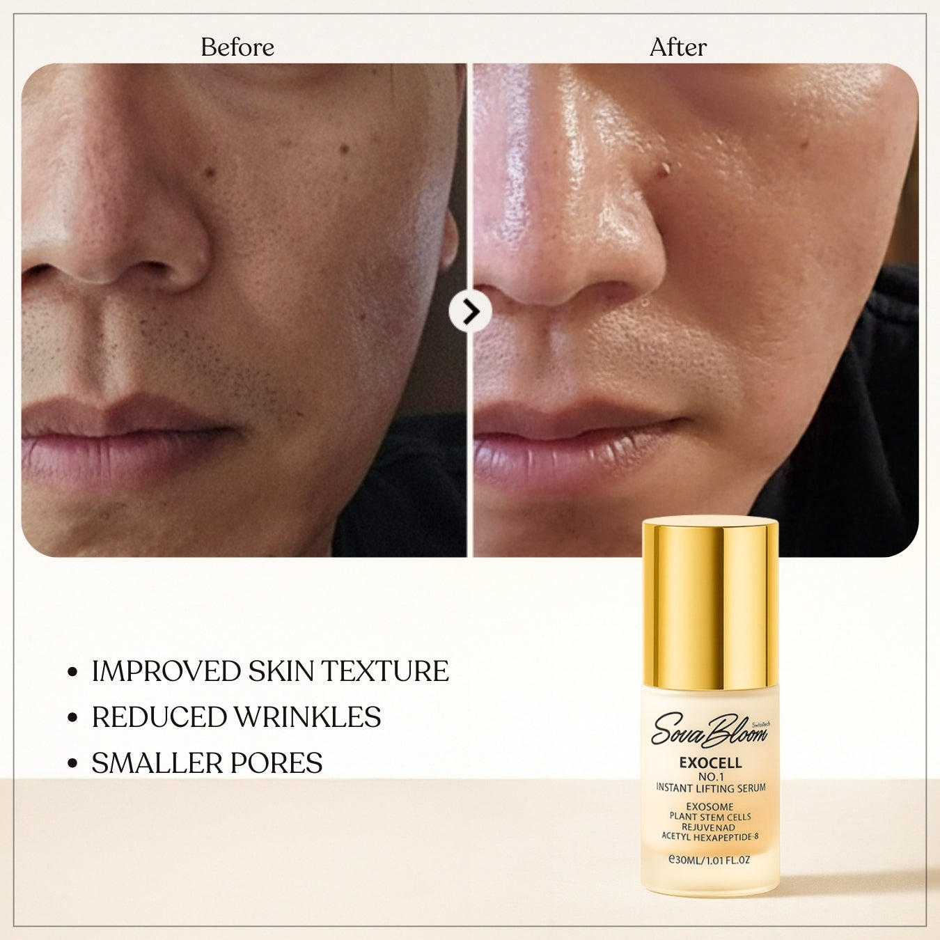 Exocell No.1 Instant Lifting Serum – Advanced Exosome Technology for Firming & Anti-Aging (30ml)