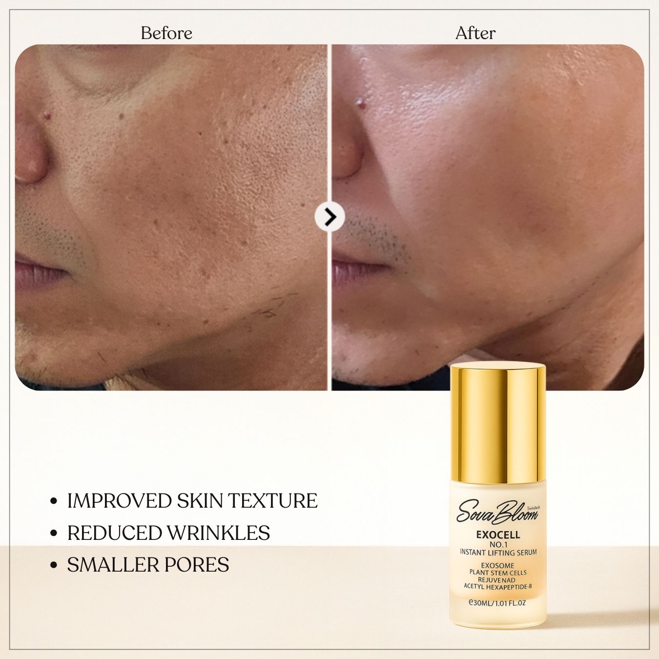 Exocell No.1 Instant Lifting Serum – Advanced Exosome Technology for Firming & Anti-Aging (30ml)