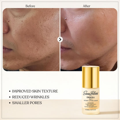 Exocell No.1 Instant Lifting Serum – Advanced Exosome Technology for Firming & Anti-Aging (30ml)