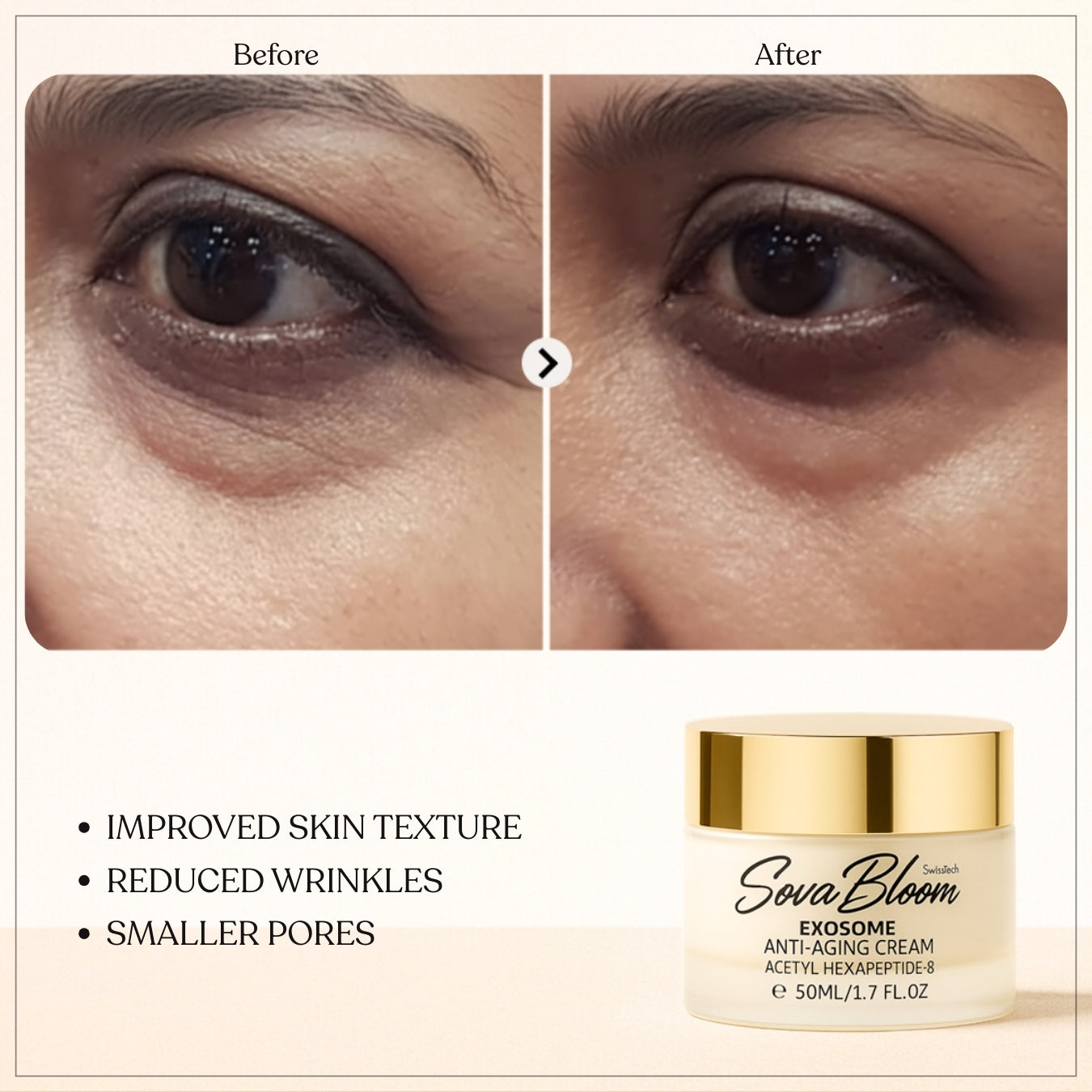 SovaBloom Exosome Anti-Aging Cream – Deep Cellular Repair Face Moisturizer for Wrinkles, Elasticity & Skin Brightening – 50ml