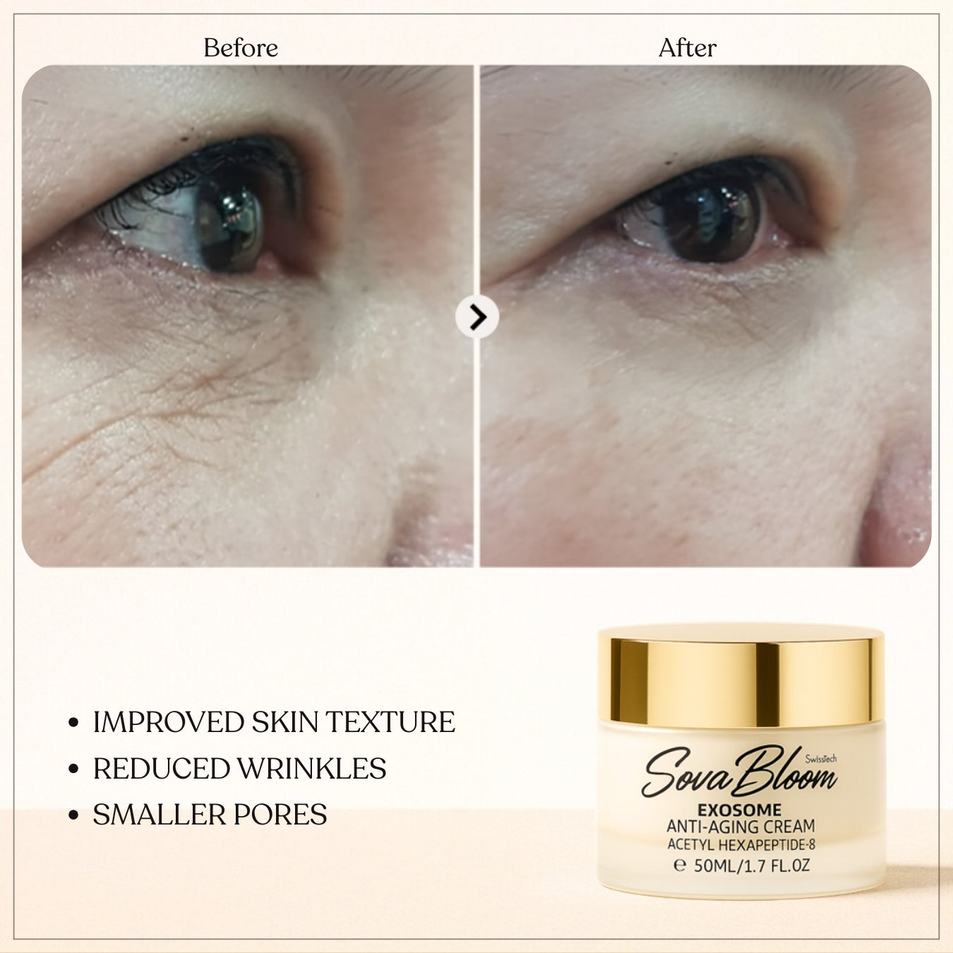 SovaBloom Exosome Anti-Aging Cream – Deep Cellular Repair Face Moisturizer for Wrinkles, Elasticity & Skin Brightening – 50ml